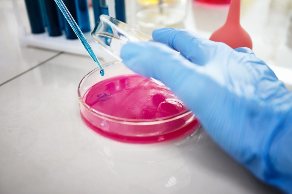 Western Blot Gel Electrophoresis