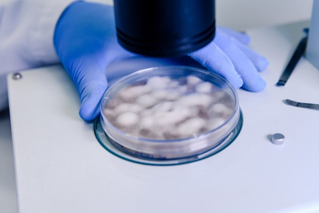 Protein Ag Magnetic Beads