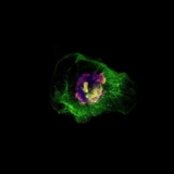 Jens Schwamborn researches the SARS-CoV2 virus on mini brains