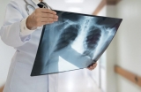 Development of Artificial Intelligence (AI) tool to detect COVID-19 condition from a chest X-ray image