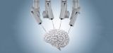 Neurosurgical Robotics Market 2020 | Exclusive Report By Fortune Market Report 2020 to 2025